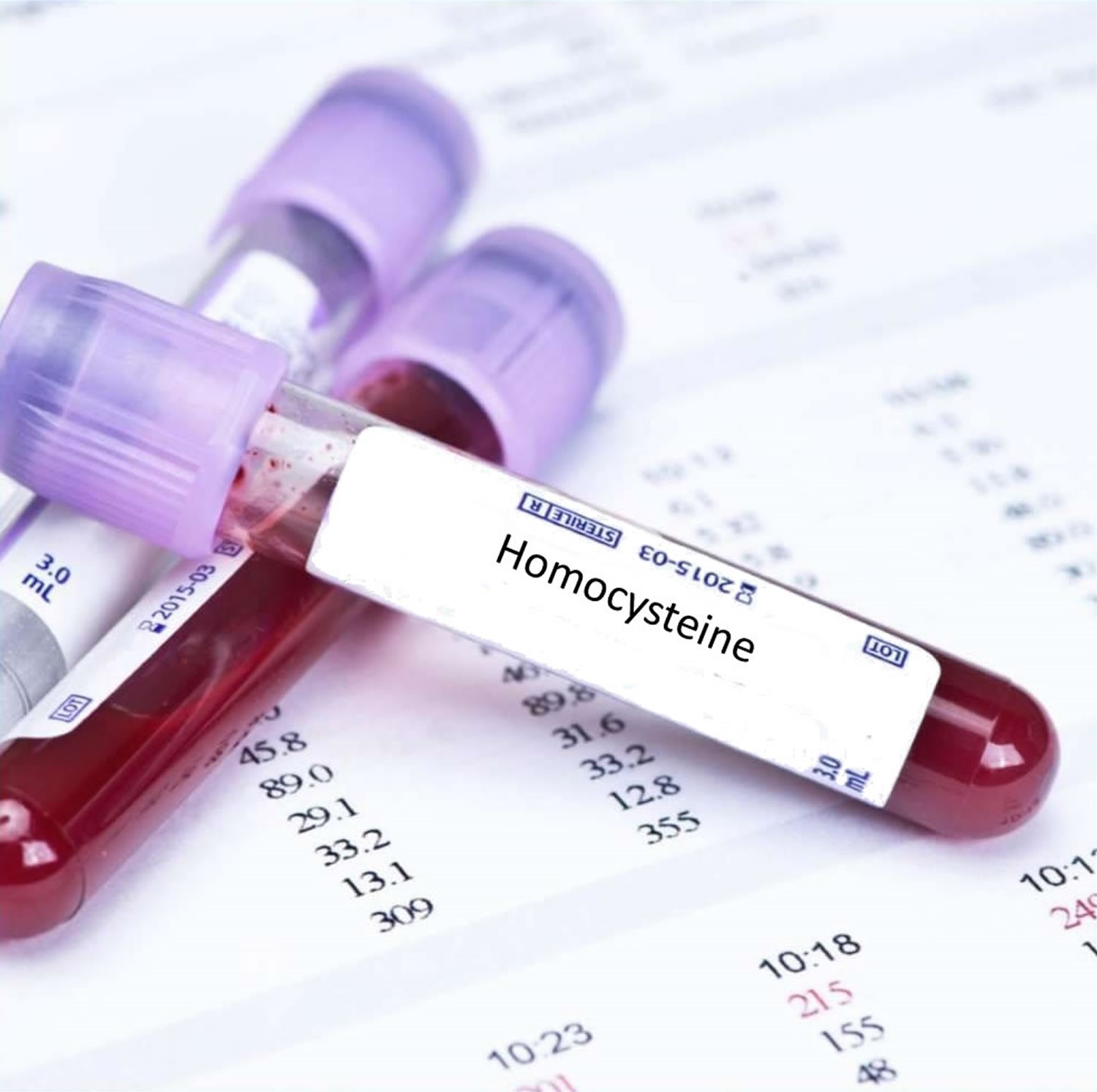 تشخیص برخی از بیماری های مغزی با آزمایش Homocysteine